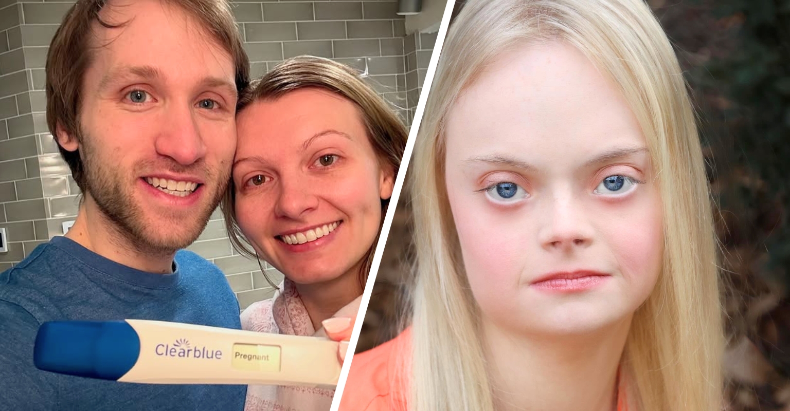 People With Down Syndrome Respond After Couple End Pregnancy Over Diagnosis